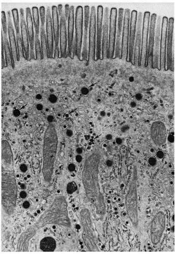 CIL:10790, Rattus, brush border epithelial cell