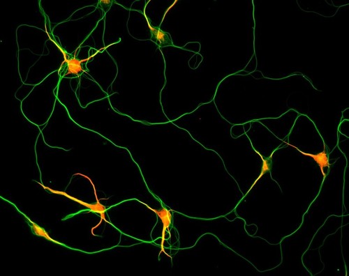 CIL:2986, Rattus, multipolar neuron