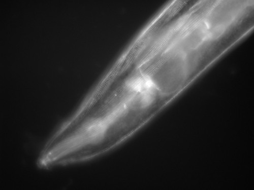 CIL:1133, Caenorhabditis elegans, muscle cell