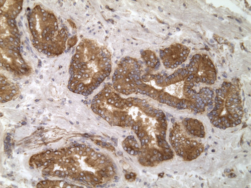 CIL:32415, Homo sapiens, endocrine-paracrine cell of prostate gland, basal cell of prostate epithelium, luminal cell of prostate epithelium, blood vessel endothelial cell, perineural cell, sheath cell, leukocyte, prostate stromal cell, smooth muscle cell of prostate