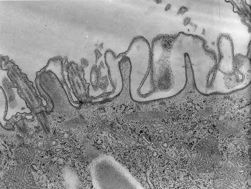 CIL:39139, Paramecium caudatum, cell by organism, eukaryotic cell, Eukaryotic Protist, Ciliated Protist