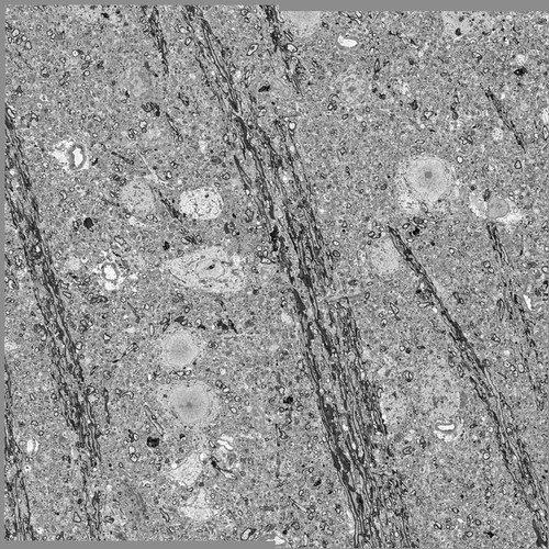 CIL: 50644, MiniSOG+ ipRGC axon labeling in the dorsallateral geniculate nucleus (vLGN)