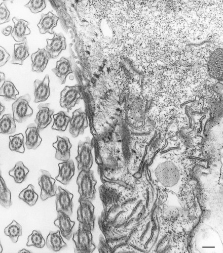 CIL:36783, Paramecium caudatum, cell by organism, eukaryotic cell, Eukaryotic Protist, Ciliated Protist