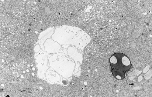 CIL:38860, Didinium nasutum, cell by organism, eukaryotic cell, Eukaryotic Protist, Ciliated Protist