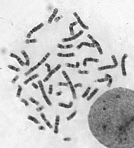 CIL: 54816, Homo sapiens Linnaeus, 1758, epithelial cell