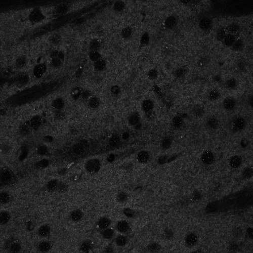 CIL:40146, Mus musculus, CNS neuron (sensu Vertebrata)