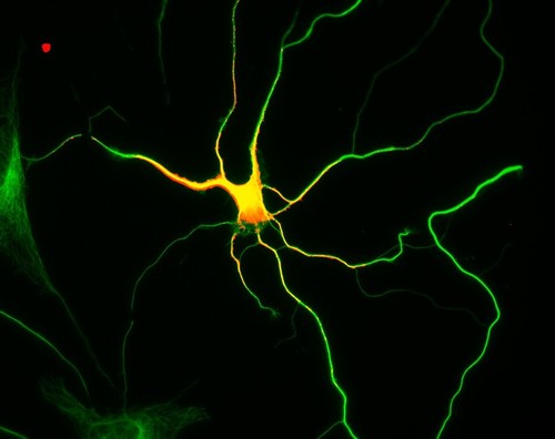 CIL:8266, Rattus, multipolar neuron