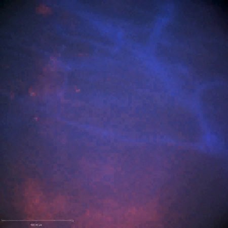CIL:47552, Staphylococcus aureus, neutrophil, endothelial cell
