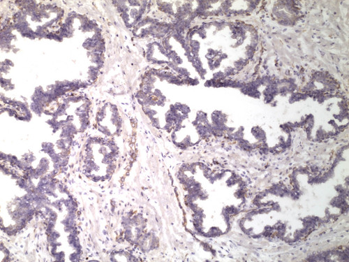 CIL:32633, Homo sapiens, endocrine-paracrine cell of prostate gland, basal cell of prostate epithelium, luminal cell of prostate epithelium, blood vessel endothelial cell, perineural cell, sheath cell, leukocyte, prostate stromal cell, smooth muscle cell of prostate