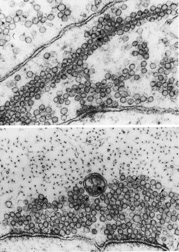 CIL:36045, Petromyzon marinus, Mauthner neuron