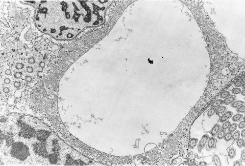 CIL:7334, Opercularia [NCBITaxon:168247], Opercularia coarctata, cell by organism, eukaryotic cell, Eukaryotic Protist, Ciliated Protist