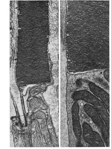 CIL:11636, Rattus sp., retinal cone cell, retinal rod cell