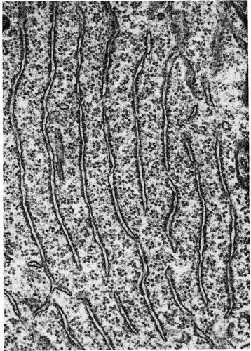 CIL:10771, motor neuron