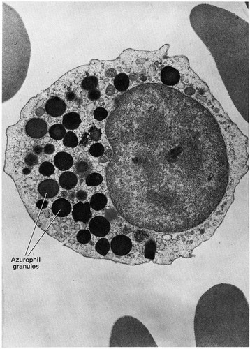 CIL:10851, Homo sapiens, neutrophilic metamyelocyte