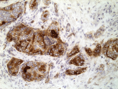 CIL:32566, Homo sapiens, endocrine-paracrine cell of prostate gland, basal cell of prostate epithelium, luminal cell of prostate epithelium, blood vessel endothelial cell, perineural cell, sheath cell, leukocyte, prostate stromal cell, smooth muscle cell of prostate