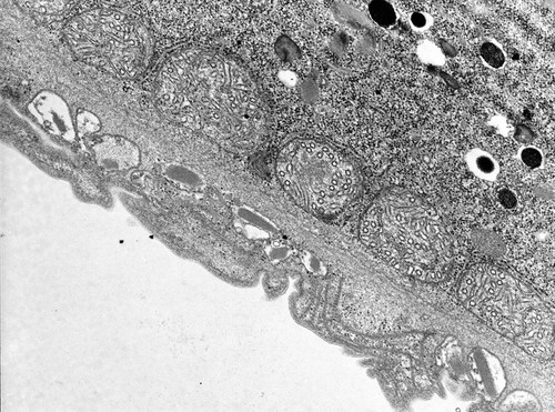 CIL:9928, Didinium nasutum, cell by organism, eukaryotic cell, Eukaryotic Protist, Ciliated Protist