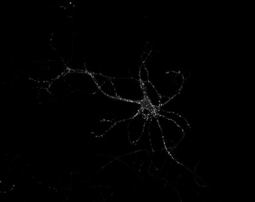 CIL:36179, Rattus, multipolar neuron