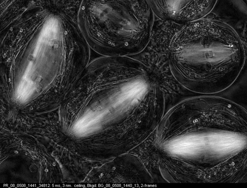 CIL:10724, Nephrotoma, Nephrotoma suturalis, primary spermatocyte