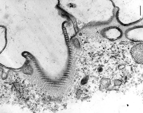 CIL:9701, Coleps hirtus, Eukaryotic Protist, Ciliated Protist