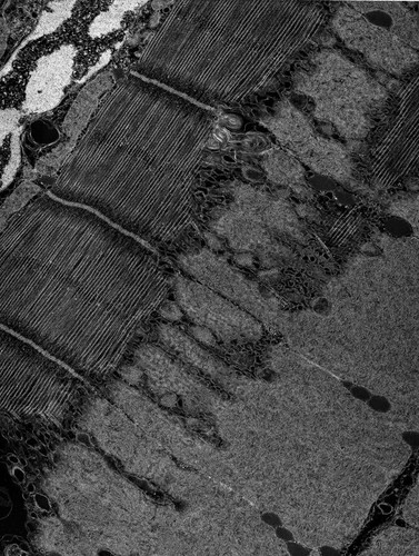 CIL:36116, damselfly, flight muscle cell