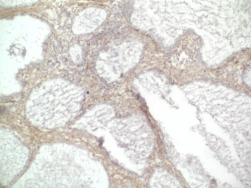 CIL:33367, Homo sapiens, endocrine-paracrine cell of prostate gland, basal cell of prostate epithelium, luminal cell of prostate epithelium, blood vessel endothelial cell, perineural cell, sheath cell, leukocyte, prostate stromal cell, smooth muscle cell of prostate