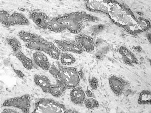 CIL:33546, Homo sapiens, endocrine-paracrine cell of prostate gland, basal cell of prostate epithelium, luminal cell of prostate epithelium, blood vessel endothelial cell, perineural cell, sheath cell, leukocyte, prostate stromal cell, smooth muscle cell of prostate