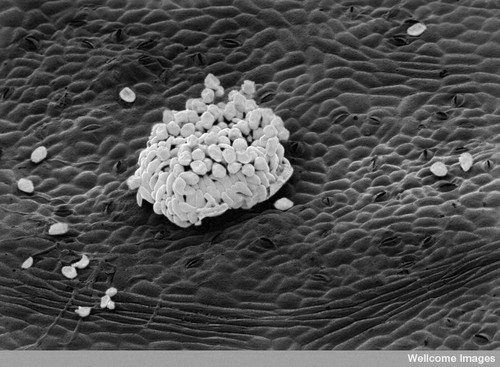 CIL:39105, Phragmidium tuberculatum, Rosa, epidermal cell, fungal spore