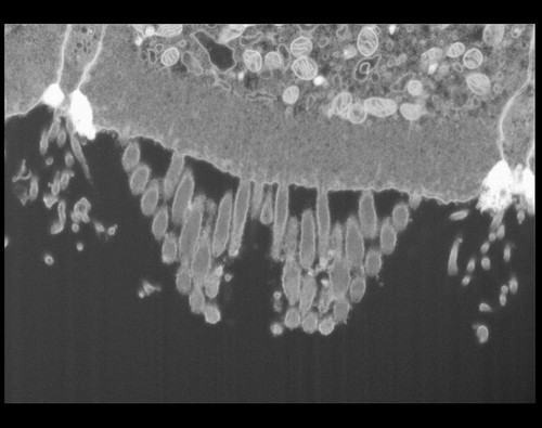 CIL: 50691, FIB-SEM Dataset of anti-PKHD1L1 Immuno-Gold Labeled Outer Hair Cell Stereocilia Bundles