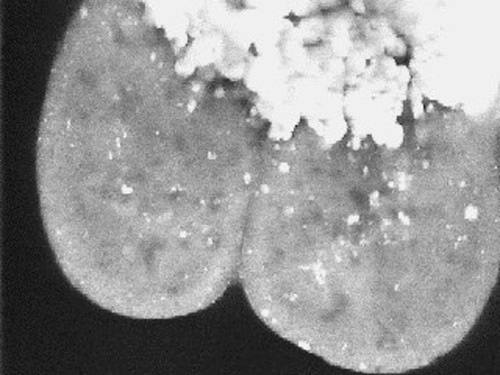 CIL:37402, Danio rerio, yolk cell