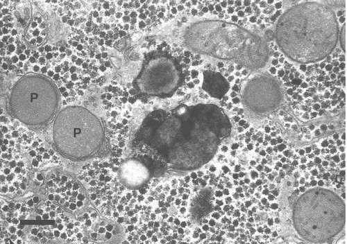 CIL:46706, Homo sapiens, parenchymal cell