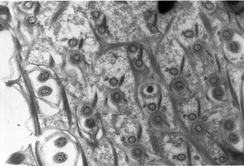 CIL:1312, Paramecium tetraurelia, cell by organism, eukaryotic cell, Eukaryotic Protist, Ciliated Protist