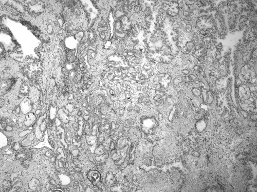 CIL:34107, Homo sapiens, endocrine-paracrine cell of prostate gland, basal cell of prostate epithelium, luminal cell of prostate epithelium, blood vessel endothelial cell, perineural cell, sheath cell, leukocyte, prostate stromal cell, smooth muscle cell of prostate