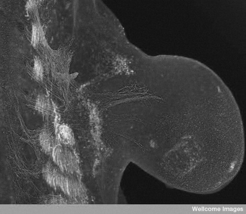 CIL:39069, Mus musculus, motor neuron