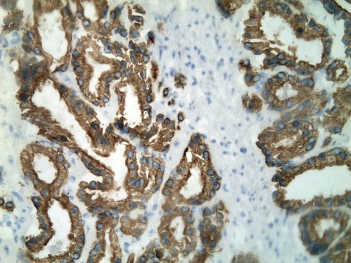 CIL:34234, Homo sapiens, endocrine-paracrine cell of prostate gland, basal cell of prostate epithelium, luminal cell of prostate epithelium, blood vessel endothelial cell, perineural cell, sheath cell, leukocyte, prostate stromal cell, smooth muscle cell of prostate