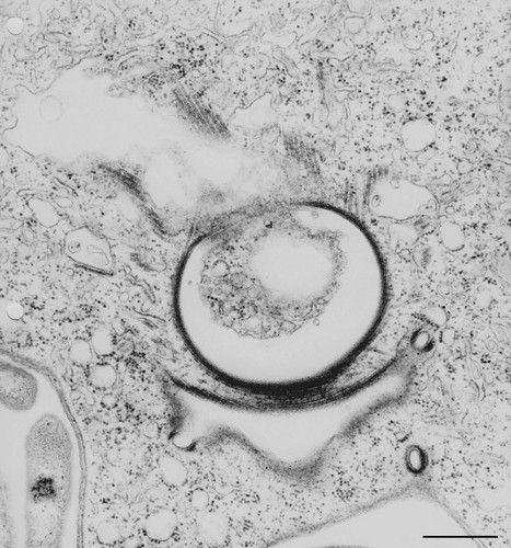 CIL:36278, Vorticella convallaria, cell by organism, eukaryotic cell, Eukaryotic Protist, Ciliated Protist