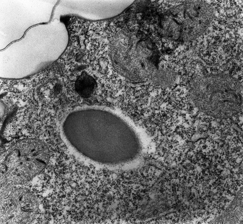 CIL:12617, Paramecium multimicronucleatum, cell by organism, eukaryotic cell, Eukaryotic Protist, Ciliated Protist