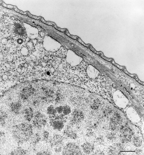 CIL:36271, Vorticella convallaria, cell by organism, eukaryotic cell, Eukaryotic Protist, Ciliated Protist