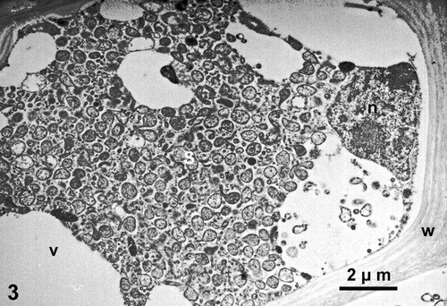 CIL:19125, Spiroplasma kunkelii, Zea mays, plant cell, prokaryotic cell