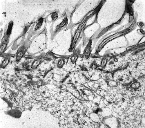 CIL:12081, Paramecium tetraurelia, cell by organism, eukaryotic cell, Eukaryotic Protist, Ciliated Protist