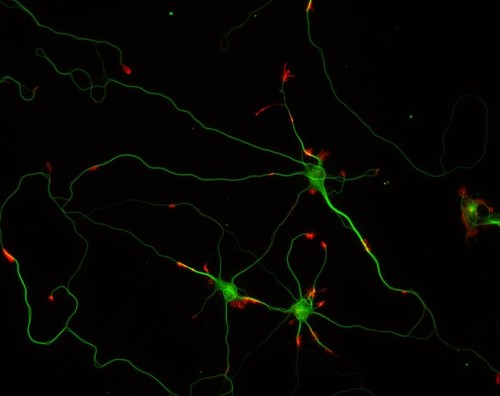 CIL:10117, Rattus, multipolar neuron