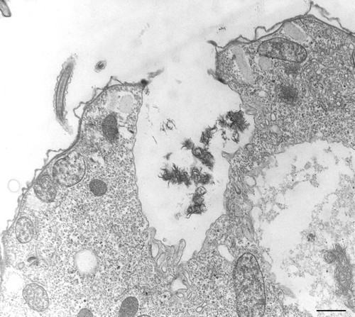 CIL:36231, Tetrahymena pyriformis, cell by organism, eukaryotic cell, Eukaryotic Protist, Ciliated Protist