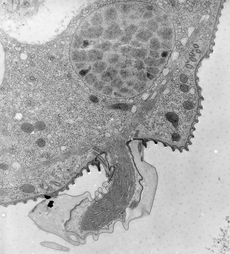 CIL:39517, Vorticella convallaria, cell by organism, eukaryotic cell, Eukaryotic Protist, Ciliated Protist