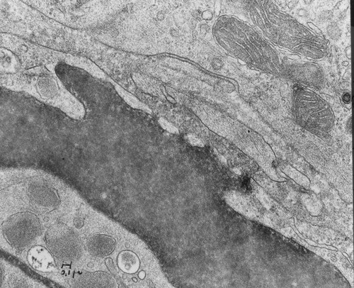 CIL:37127, Mus musculus, capillary endothelial cell, fenestrated cell