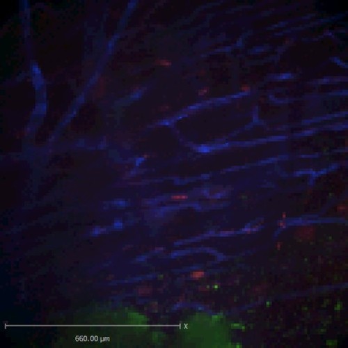 CIL:47547, Staphylococcus aureus, neutrophil, endothelial cell