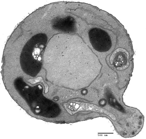 CIL:39690, Saccharomyces cerevisiae, BY4716