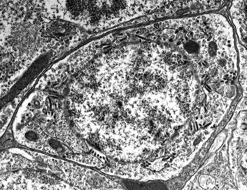 CIL:25372, Maize mosaic virus, Peregrinus maidis, neuron associated cell