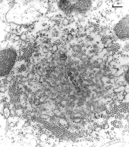 CIL:13112, Paramecium multimicronucleatum, cell by organism, eukaryotic cell, Eukaryotic Protist, Ciliated Protist