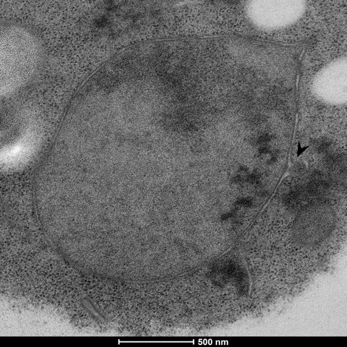 CIL: 50846, Saccharomyces cerevisiae (baker's yeast, budding yeast), Mixed population of S. cerevisiae cells