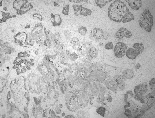 CIL:33555, Homo sapiens, endocrine-paracrine cell of prostate gland, basal cell of prostate epithelium, luminal cell of prostate epithelium, blood vessel endothelial cell, perineural cell, sheath cell, leukocyte, prostate stromal cell, smooth muscle cell of prostate