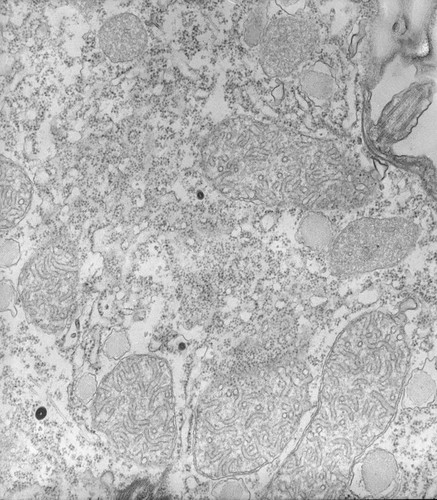 CIL:34532, Tetrahymena pyriformis, cell by organism, eukaryotic cell, Eukaryotic Protist, Ciliated Protist